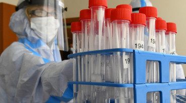 koronavirus, vzorky, testy