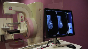 mamograf