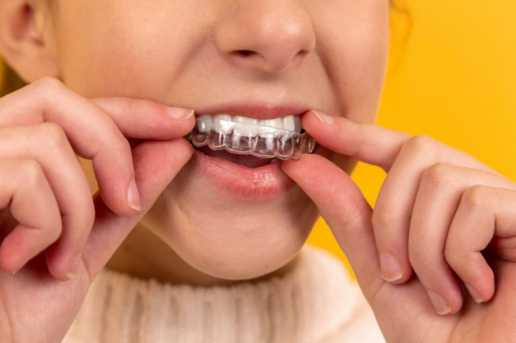 6 najväčších mýtov o bielení zubov, ktorým by ste nemali veriť