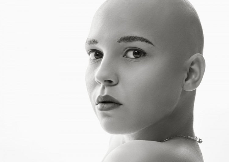 S rakovinou prsníka bojuje stále viac mladých žien. Vek je pri liečbe skôr záťažou